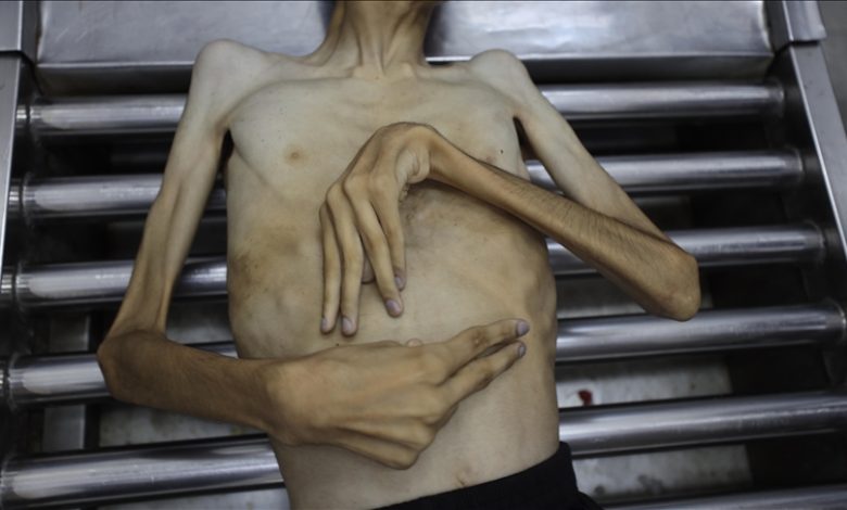 Photo of Le chef de l’UNRWA condamne le refus d’Israël de reconnaître la famine à Gaza comme « honteux »