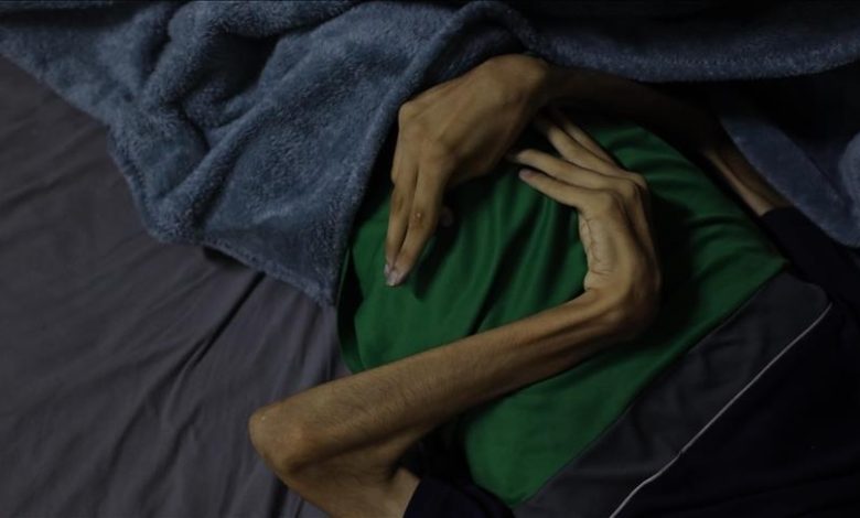 Photo of Gaza : la famine fait 10 morts supplémentaires sous blocus israélien