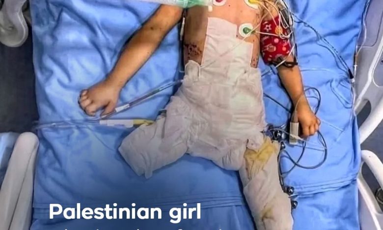 Photo of Enfants martyrs de Gaza: Wafaa succombe à ses blessures